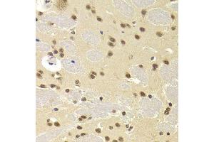 Immunohistochemistry (Paraffin-embedded Sections) (IHC (p)) image for anti-Small Nuclear Ribonucleoprotein Polypeptide A (SNRPA) (AA 1-282) antibody (ABIN6148210)