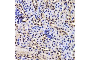 Immunohistochemistry of paraffin-embedded Mouse kidney using GABPB1 antibody at dilution of 1:100 (x400 lens). (GABPB1 antibody)