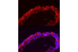Immunofluorescence analysis of human testis cells using SP Rabbit pAb (ABIN3022967, ABIN3022968, ABIN1513554 and ABIN6219322) at dilution of 1:150 (40x lens). (SPAM1 antibody  (AA 100-300))