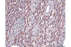 IHC analysis of Alpha 2 Antiplasmin/SERPINF2 using anti-Alpha 2 Antiplasmin/SERPINF2 antibody (ABIN7601808). (alpha 2 Antiplasmin antibody  (AA 461-491))