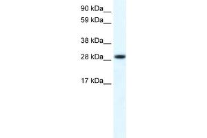 WB Suggested Anti-FHL1 Antibody Titration:  0.