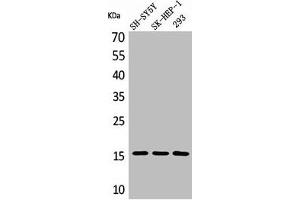 Western Blot analysis of SH-SY5Y 293 SK-HEP-1 cells using Phospho-Synuclein-α (Y125) Polyclonal Antibody (SNCA antibody  (pTyr125))
