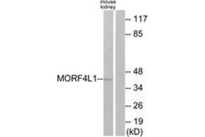 Western blot analysis of extracts from mouse kidney cells, using MORF4L1 Antibody. (MORF4L1 antibody  (AA 31-80))