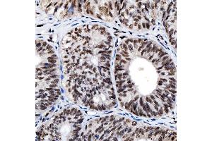 IHC analysis of SNRNP200 using anti-SNRNP200 antibody (ABIN7602032). (SNRNP200 antibody  (AA 557-2129))