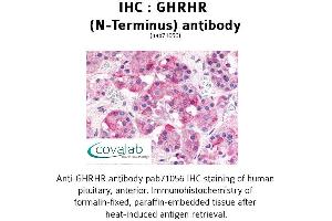Image no. 1 for anti-Growth Hormone Releasing Hormone Receptor (GHRHR) (Extracellular Domain), (N-Term) antibody (ABIN1734693)