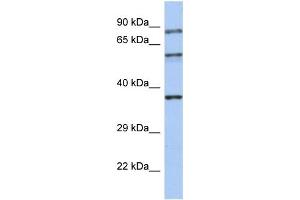 WB Suggested Anti-RPH3A Antibody Titration:  0. (RPH3A antibody  (N-Term))