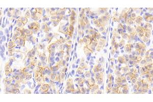 Detection of CK13 in Human Stomach Tissue using Polyclonal Antibody to Cytokeratin 13 (CK13) (Cytokeratin 13 antibody  (AA 104-403))