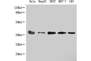 Western Blot Positive WB detected in: PPA1 antibody at 1:1000 Lane 1: Hela whole cell lysate Lane 2: HepG2 whole cell lysate Lane 3: 293T whole cell lysate Lane 4: MCF-7 whole cell lysate Lane 5: U87 whole cell lysate Secondary Goat polyclonal to Mouse IgG at 1/20000 dilution Predicted band size: 33KDa Observed band size: 33 KDa Exposure time: 5 min (Histone 3 antibody  (AA 1-289))
