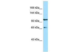 WB Suggested Anti-ESF1 Antibody Titration: 1. (ESF1 antibody  (C-Term))