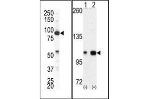 (LEFT)Western blot analysis of anti-EphA4 Pab in NCI-H460 cell lysate. (EPH Receptor A4 antibody  (C-Term))