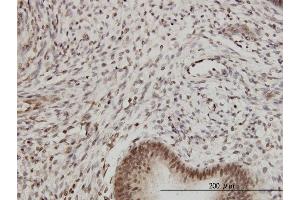 Immunoperoxidase of monoclonal antibody to PSMB2 on formalin-fixed paraffin-embedded human endometrium.
