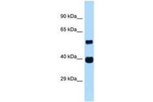 Image no. 1 for anti-Ankyrin Repeat and SOCS Box Containing 4 (ASB4) (AA 191-240) antibody (ABIN6747354) (ASB4 antibody  (AA 191-240))