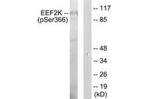 Western blot analysis of extracts from HeLa cells treated with serum 10 % 15', using eEF2K (Phospho-Ser366) Antibody. (EEF2K antibody  (pSer366))