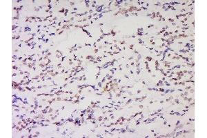 Formalin-fixed and paraffin embedded rat brain labeled with Anti-NSD1 Polyclonal Antibody, Unconjugated  at 1:200 followed by conjugation to the secondary antibody and DAB staining. (NSD1 antibody  (AA 2401-2600))