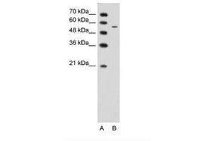 Image no. 1 for anti-Carbohydrate (N-Acetylglucosamine 6-O) Sulfotransferase 7 (CHST7) (AA 256-305) antibody (ABIN203380) (CHST7 antibody  (AA 256-305))
