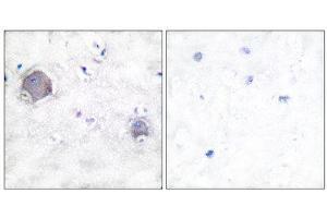 Immunohistochemistry (IHC) image for anti-Notch 1 (NOTCH1) (Cleaved-Val1754), (Internal Region) antibody (ABIN1853473) (Notch1 antibody  (Cleaved-Val1754, Internal Region))