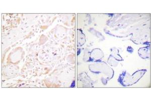 Immunohistochemistry analysis of paraffin-embedded human placenta tissue using GATA3 antibody. (GATA3 antibody)