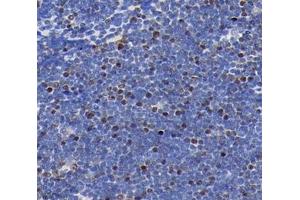 Immunohistochemistry analysis of paraffin-embedded rat thymus using,MLLT11 (ABIN7074715) at dilution of 1: 4000 (MLLT11 antibody)