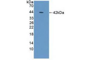 Western blot analysis of recombinant Human DEFa1B.