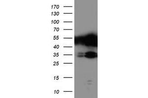 HEK293T cells were transfected with the pCMV6-ENTRY control (Left lane) or pCMV6-ENTRY TAL1 (Right lane) cDNA for 48 hrs and lysed. (TAL1 antibody)