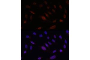Immunofluorescence analysis of U2OS cells using Bcl9 Rabbit pAb (ABIN7265817) at dilution of 100 (40x lens). (BCL9 antibody)