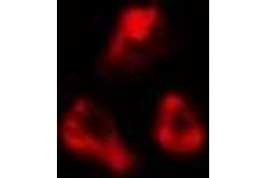 ABIN6277053 staining  LOVO cells by IF/ICC. (CDKN3 antibody  (Internal Region))
