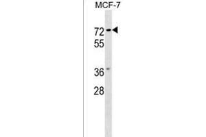NOTUM Antibody (C-term) (ABIN1537190 and ABIN2849368) western blot analysis in MCF-7 cell line lysates (35 μg/lane). (NOTUM antibody  (C-Term))
