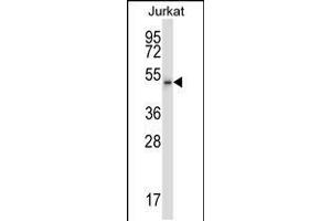 Western blot analysis in Jurkat cell line lysates (35ug/lane). (Cyclin-Dependent Kinase 15 (ALS2CR7) (AA 96-124), (N-Term) antibody)
