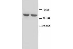 Image no. 2 for anti-Glutamate Decarboxylase 1 (Brain, 67kDa) (GAD1) (N-Term) antibody (ABIN1495050) (GAD antibody  (N-Term))