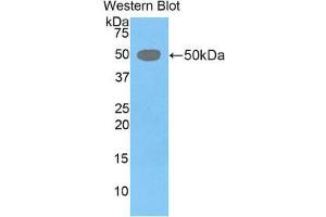 Western Blotting (WB) image for anti-Left-Right Determination Factor 1 (LEFTY1) (AA 169-368) antibody (ABIN1859645) (LEFTY1 antibody  (AA 169-368))