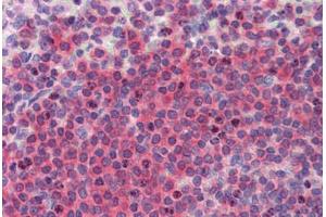 Human Spleen (formalin-fixed, paraffin-embedded) stained with  antibody ABIN462274 followed by biotinylated secondary antibody, alkaline phosphatase-streptavidin and chromogen.