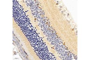 Immunohistochemistry of paraffin embedded mouse eye using C1QL2 (ABIN7073561) at dilution of 1: 1000 (400x lens (C1QL2 antibody)
