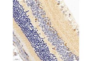 Immunohistochemistry of paraffin embedded mouse eye using C1QL2 (ABIN7073561) at dilution of 1: 1000 (400x lens