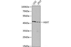 Western blot analysis of extracts of various cell lines using AGXT Polyclonal Antibody at dilution of 1:1000. (AGXT antibody)