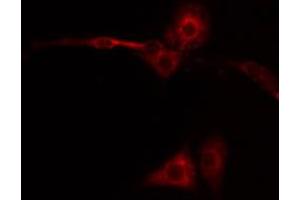 ABIN6267449 staining NIH-3T3 by IF/ICC. (CXCR2 antibody  (pSer347))