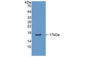 Figure. (REG3B antibody  (AA 27-175))