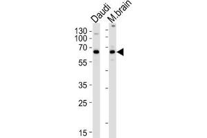 Western Blotting (WB) image for anti-Protein Kinase C and Casein Kinase Substrate in Neurons 2 (PACSIN2) antibody (ABIN3003675) (PACSIN2 antibody)