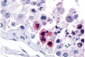 Human Testis: Formalin-Fixed, Paraffin-Embedded (FFPE) (RORC antibody  (AA 110-159))