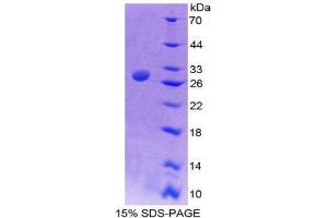 SDS-PAGE (SDS) image for Nucleoporin 50kDa (NUP50) (AA 37-269) protein (His tag) (ABIN2126161) (NUP50 Protein (AA 37-269) (His tag))