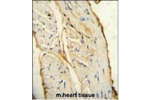 AIF1 antibody (N-term) (ABIN654407 and ABIN2844145) immunohistochemistry analysis in formalin fixed and paraffin embedded mouse heart tissue followed by peroxidase conjugation of the secondary antibody and DAB staining. (Iba1 antibody  (N-Term))