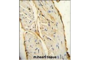 AIF1 antibody (N-term) (ABIN654407 and ABIN2844145) immunohistochemistry analysis in formalin fixed and paraffin embedded mouse heart tissue followed by peroxidase conjugation of the secondary antibody and DAB staining. (Iba1 antibody  (N-Term))