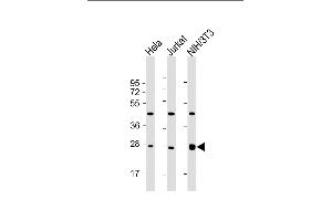 All lanes : Anti-EIF4E Antibody at 1:2000 dilution Lane 1: Hela whole cell lysate Lane 2: Jurkat whole cell lysate Lane 3: NIH/3T3 whole cell lysate Lysates/proteins at 20 μg per lane. (EIF4E antibody)