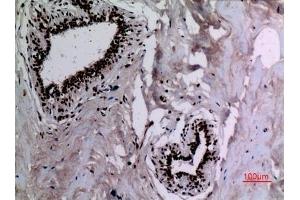Immunohistochemical analysis of paraffin-embedded human-breast, antibody was diluted at 1:100. (HSP90 antibody  (acLys284, acLys292))