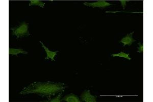 Immunofluorescence of monoclonal antibody to EFHD1 on HeLa cell. (EFHD1 antibody  (AA 168-238))