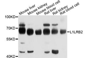 Western blot analysis of extracts of various cells, using LILRB2 antibody. (LILRB2 antibody)