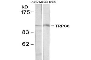 Image no. 1 for anti-Transient Receptor Potential Cation Channel, Subfamily C, Member 6 (TRPC6) (N-Term) antibody (ABIN319369) (TRPC6 antibody  (N-Term))