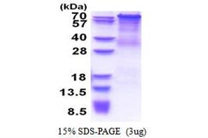 SDS-PAGE (SDS) image for Protocadherin gamma Subfamily C, 4 (PCDHGC4) (AA 30-692) protein (His tag) (ABIN5853495) (PCDHGC4 Protein (AA 30-692) (His tag))