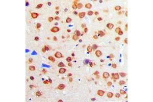 Immunohistochemical analysis of IGF1 Receptor staining in human brain formalin fixed paraffin embedded tissue section. (IGF1R antibody  (C-Term))