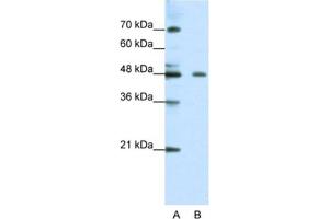 Western Blotting (WB) image for anti-Zinc Finger Protein 645 (ZNF645) antibody (ABIN2461310) (ZNF645 antibody)
