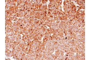 IHC-P Image Immunohistochemical analysis of paraffin-embedded BT483 xenograft, using HSP90 beta, antibody at 1:100 dilution. (HSP90AB1 antibody  (N-Term))